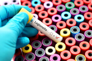 Combatir la legionella en Navarra